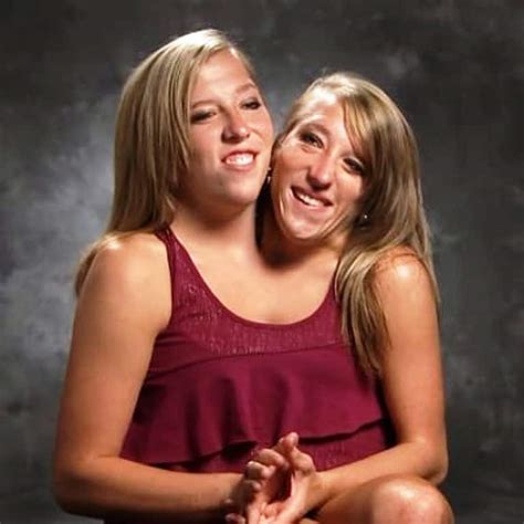 sexy conjoined twins